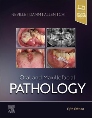Oral and Maxillofacial Pathology cover