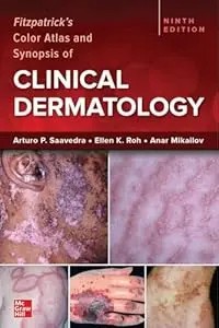 Fitzpatrick's Color Atlas and Synopsis of Clinical Dermatology, 9/e